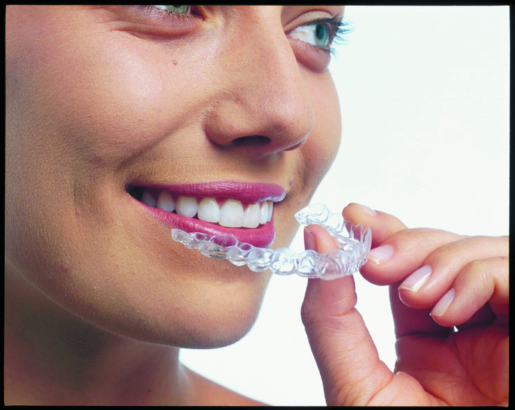 Inserting aligners 1.jpg